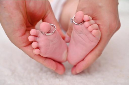 伊川孕妇怎样预防妊娠纹